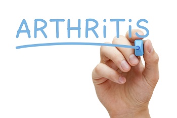 Arthritis Image